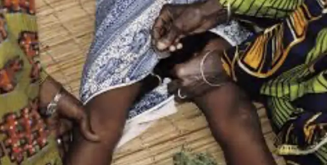Female Genital mutilation